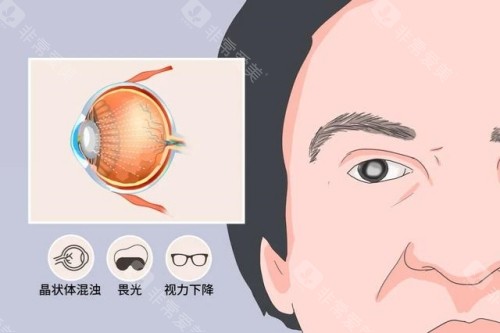 玉溪市人民医院眼科收费价格表:近视9600元起、白内障5000元起、青光眼6000元起