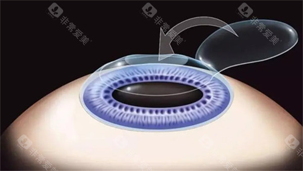 票选北医三院眼科医生排名榜：马志中、洪晶、陈跃国、封康、齐虹医生个人简介资料公布！