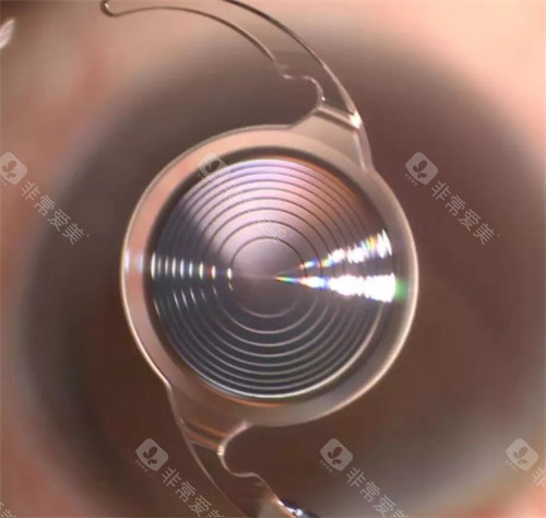 衢州江山康利眼科医院怎么样?是正规医院吗?如何预约挂号?简介地址和营业时间公布！