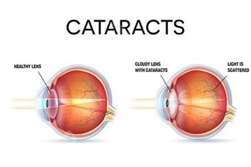 同仁眼科人工热线电话010-58269911，专属客服对接，眼科问题快速解答