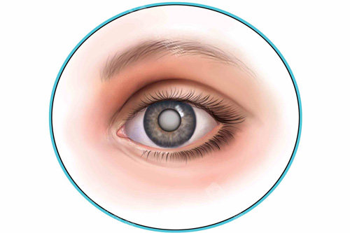 【网友实测】河源白内障技术好的医生排名榜：这5位医生手术稳、改善快！