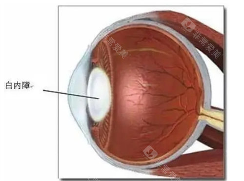 合肥沃瑞眼科医院付玲玲怎么样？合肥沃瑞眼科院长，30年眼科深耕眼科手术！