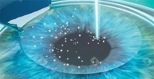 别错过！2026眼科免费24小时询问入口，医院信息、项目报价、新技术一网打尽！